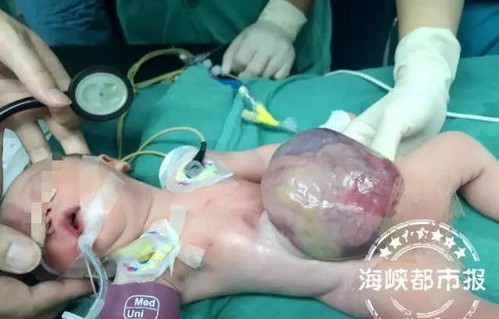 新生奇迹，出生仅两天的宝宝遭遇烫伤，重获新生皮肤