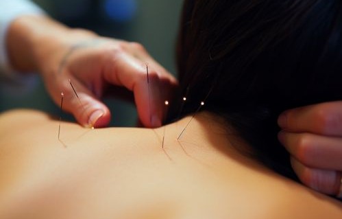 女子养生馆针灸意外，肺被扎破的深度解析