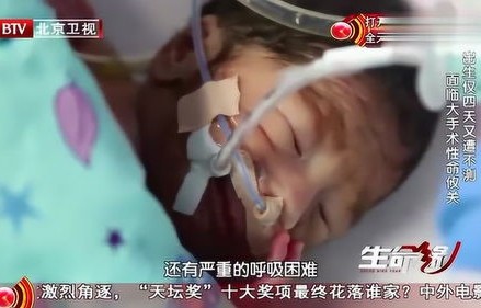 四胎母亲的痛与坚强——被老师砸破头骨女童的成长之路