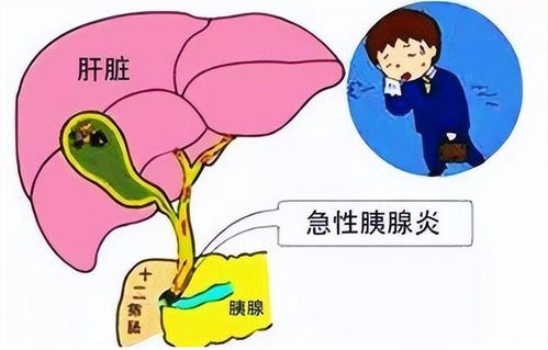 32岁网红直播后突发脑溢血，生命的脆弱与警醒