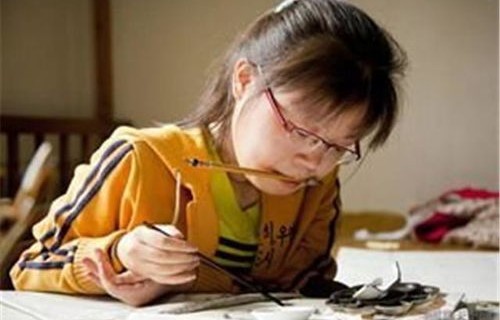 女生确诊渐冻症一年，容貌巨变背后的坚韧与勇气