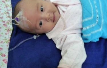 三岁宝宝全身起皮，脱衣如雪的奇妙现象