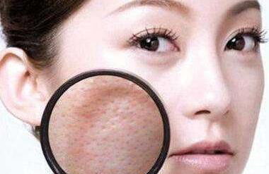 女子头痛频发,竟因鼻子发霉之谜 女子头痛频发,竟因鼻子发霉之谜