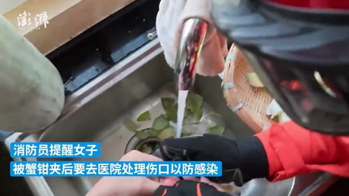 女子遭遇钳力,一公斤重螃蟹夹手,紧急求助119 女子遭遇钳力,一公斤重螃蟹夹手,紧急求助119