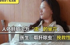 全球首例同时换脸换手男子喜结良缘