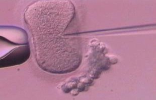 惊魂一刻，7岁孩子做雾化后咳出一条活体蚂蝗