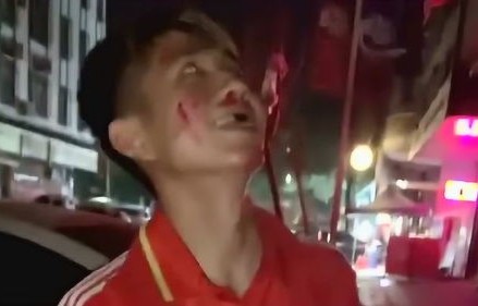 广东小伙遭遇媚眼蛇的硬控