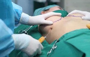 十二岁女孩误诊,月经不调背后的癌症阴影