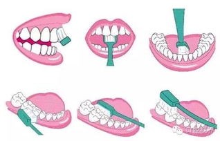 该怎么刷(该怎么刷牙才正确)