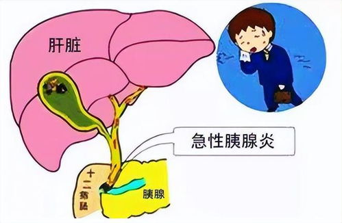 32岁网红直播后突发脑溢血,生命的脆弱与警醒 32岁网红直播后突发脑溢血,生命的脆弱与警醒