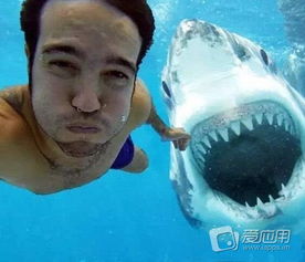 女子遭遇意外,鲨鱼夹碎裂扎入头部 女子遭遇意外,鲨鱼夹碎裂扎入头部