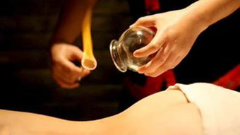 女生美容院拔罐后变身紫薯精的奇妙经历