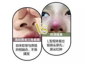 21岁女孩因隆鼻手术意外离世，警惕整形手术风险