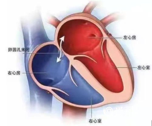 牙周病与脑卒中风险，一项潜在的健康关联